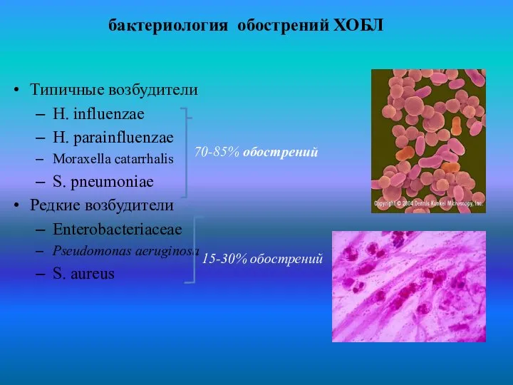 бактериология обострений ХОБЛ Типичные возбудители H. influenzae H. parainfluenzae Moraxella catarrhalis