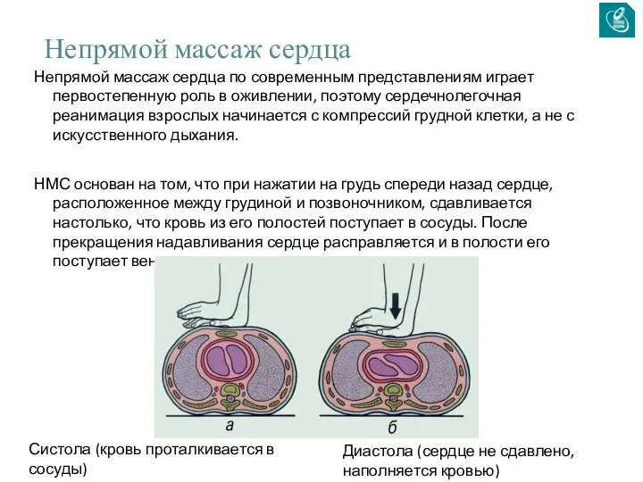 Непрямой массаж сердца Непрямой массаж сердца по современным представлениям играет первостепенную