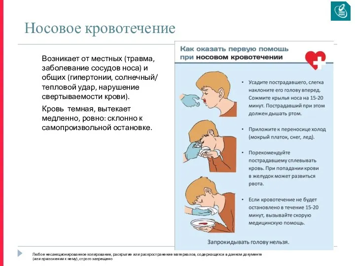 Носовое кровотечение Возникает от местных (травма, заболевание сосудов носа) и общих