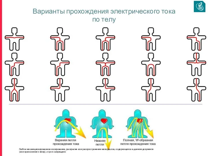 Варианты прохождения электрического тока по телу Любое несанкционированное копирование, раскрытие или