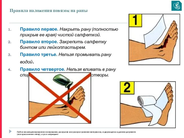 Правила наложения повязок на раны Правило первое. Накрыть рану (полностью прикрыв
