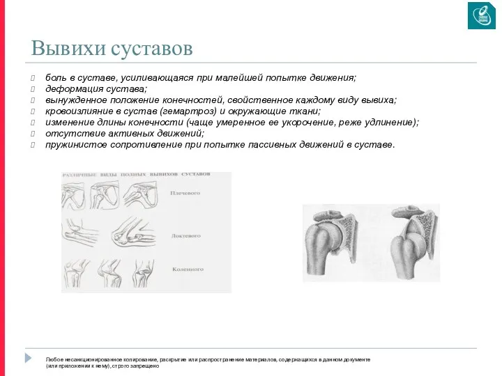 Вывихи суставов боль в суставе, усиливающаяся при малейшей попытке движения; деформация