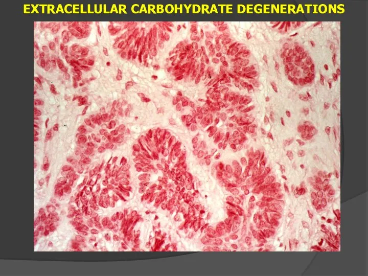 EXTRACELLULAR CARBOHYDRATE DEGENERATIONS