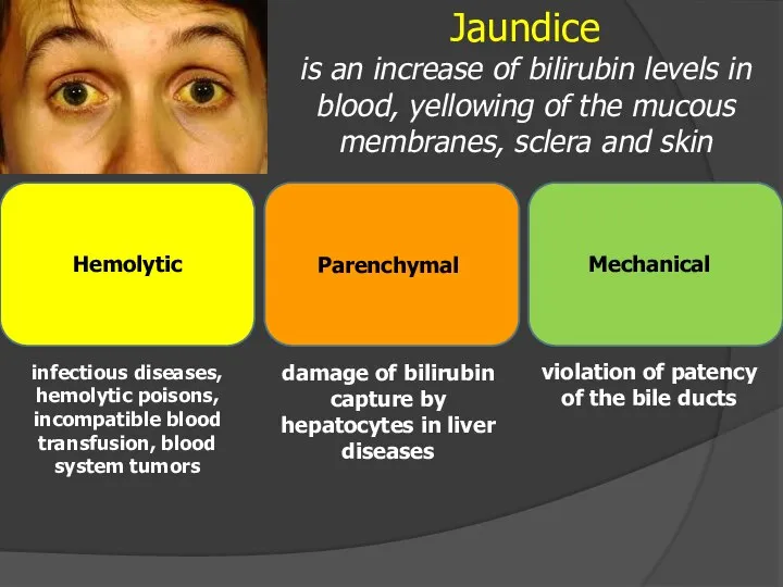 Jaundice is an increase of bilirubin levels in blood, yellowing of