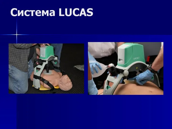 Система LUCAS