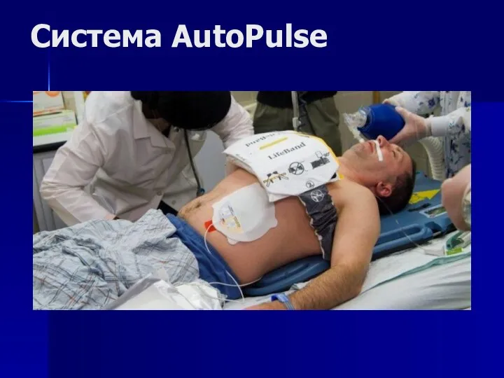 Система AutoPulse