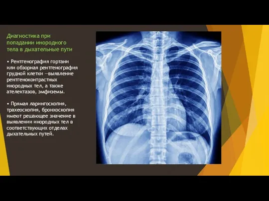Диагностика при попадании инородного тела в дыхательные пути • Рентгенография гортани