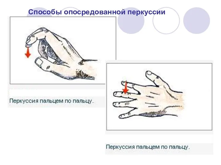 Способы опосредованной перкуссии