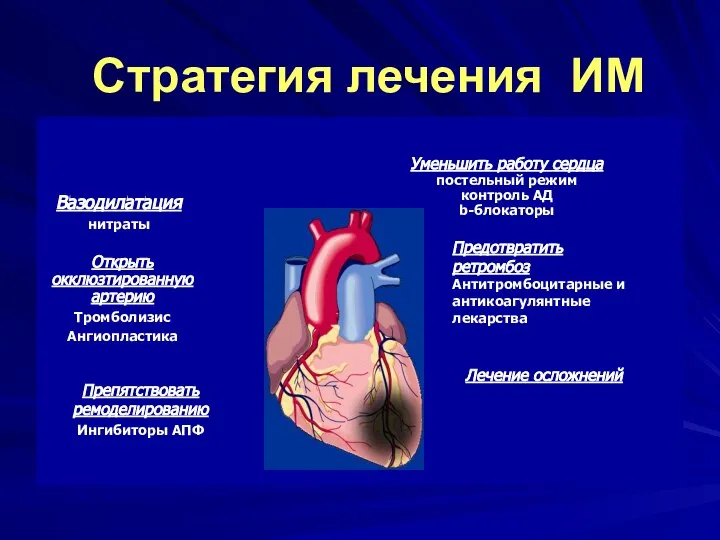 Стратегия лечения ИМ