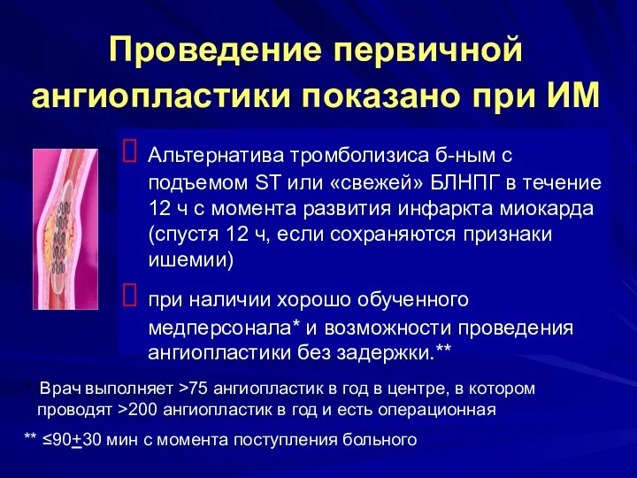 Проведение первичной ангиопластики показано при ИМ Альтернатива тромболизиса б-ным с подъемом