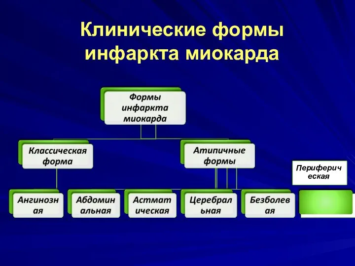 Клинические формы инфаркта миокарда