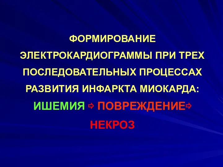 ФОРМИРОВАНИЕ ЭЛЕКТРОКАРДИОГРАММЫ ПРИ ТРЕХ ПОСЛЕДОВАТЕЛЬНЫХ ПРОЦЕССАХ РАЗВИТИЯ ИНФАРКТА МИОКАРДА: ИШЕМИЯ ⇨ ПОВРЕЖДЕНИЕ⇨ НЕКРОЗ