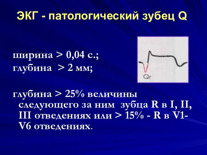 ширина > 0,04 с.; глубина > 2 мм; глубина > 25%