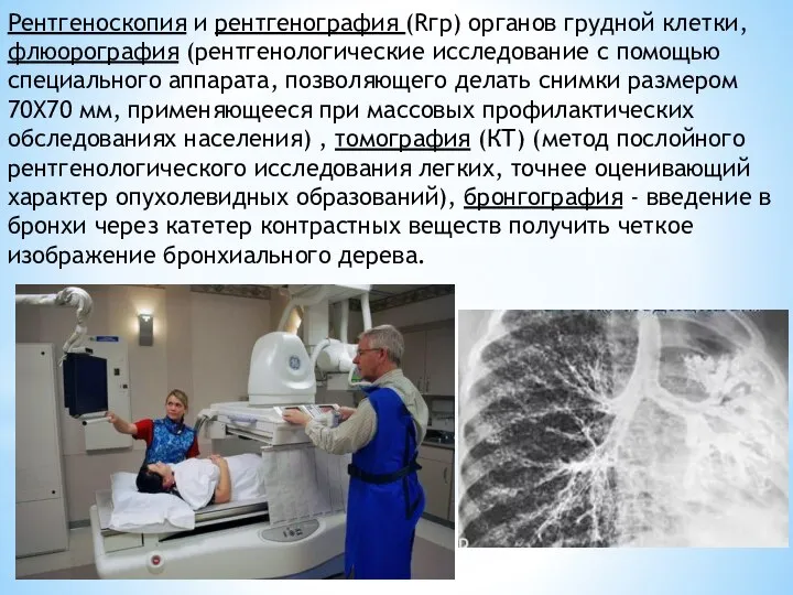 Рентгеноскопия и рентгенография (Rгр) органов грудной клетки, флюорография (рентгенологические исследование с