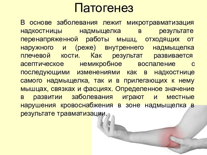 Патогенез В основе заболевания лежит микротравматизация надкостницы надмыщелка в результате перенапряженной