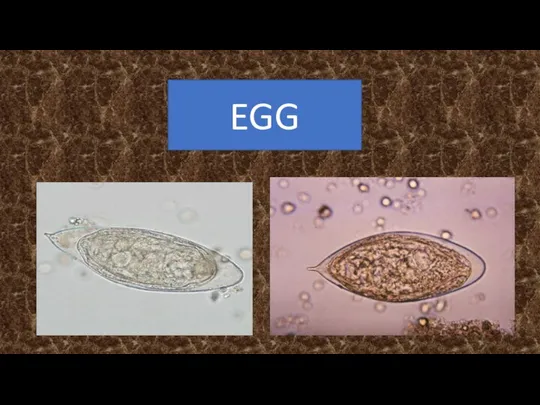 EGG