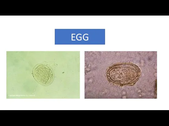 EGG