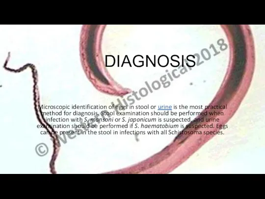 DIAGNOSIS Microscopic identification of eggs in stool or urine is the