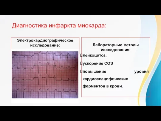 Диагностика инфаркта миокарда: Электрокардиографическое исследование: Лабораторные методы исследования: лейкоцитоз, ускорение СОЭ