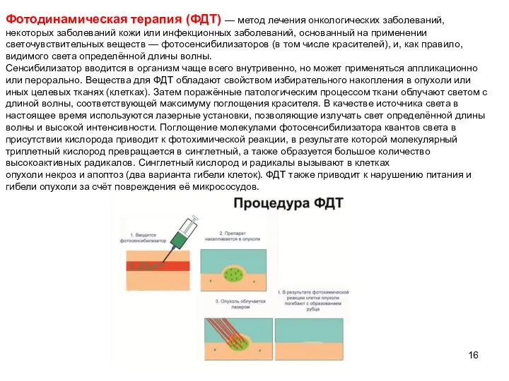 Фотодинамическая терапия (ФДТ) — метод лечения онкологических заболеваний, некоторых заболеваний кожи