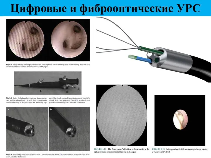 Цифровые и фиброоптические УРС