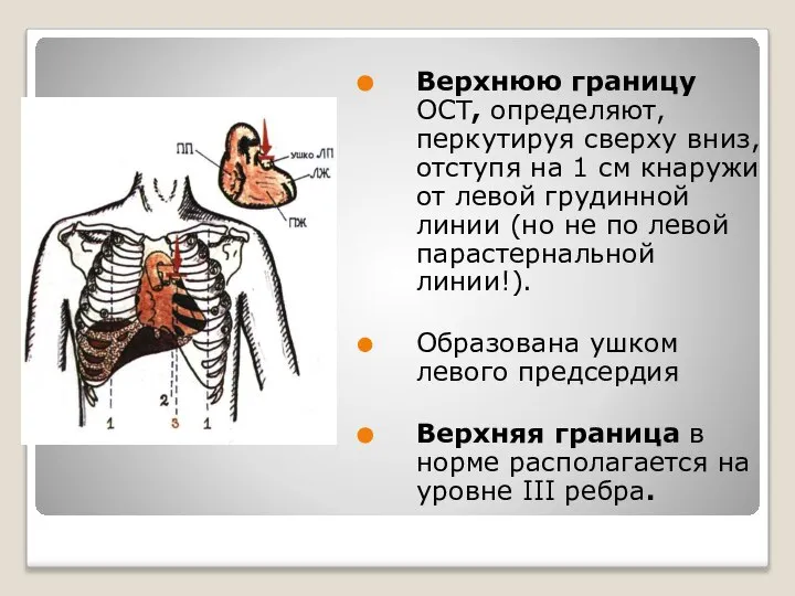 Верхнюю границу ОСТ, определяют, перкутируя сверху вниз, отступя на 1 см