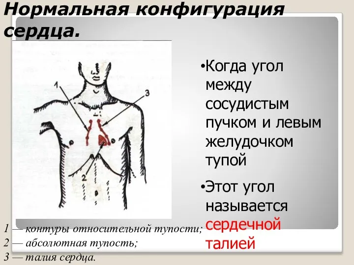 Нормальная конфигурация сердца. 1 — контуры относительной тупости; 2 — абсолютная