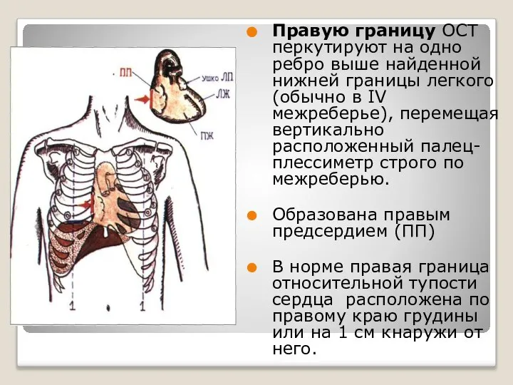 Правую границу ОСТ перкутируют на одно ребро выше найденной нижней границы