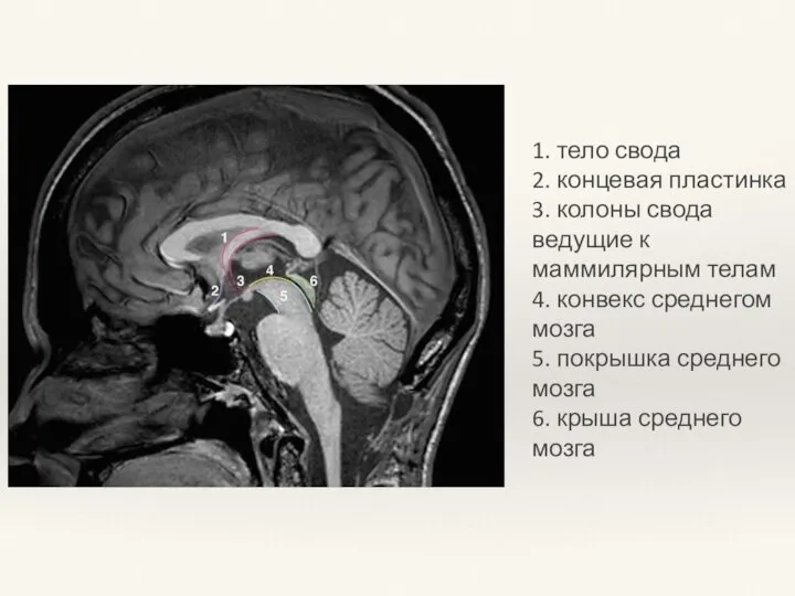 1. тело свода 2. концевая пластинка 3. колоны свода ведущие к