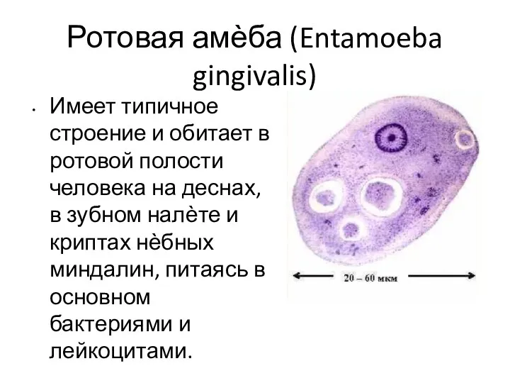 Ротовая амѐба (Entamoeba gingivalis) Имеет типичное строение и обитает в ротовой