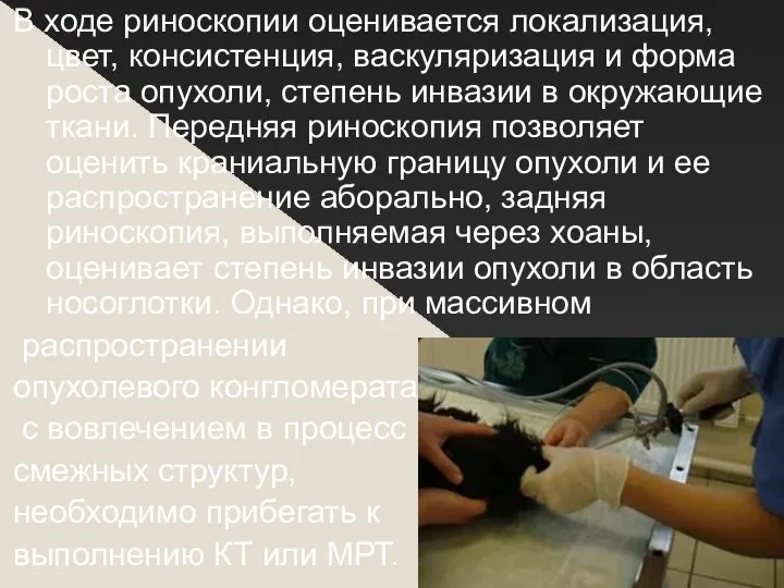 В ходе риноскопии оценивается локализация, цвет, консистенция, васкуляризация и форма роста