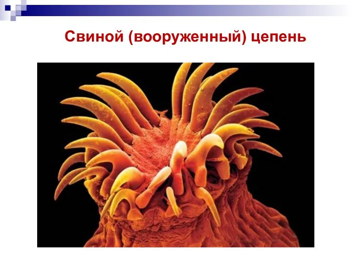 Свиной (вооруженный) цепень