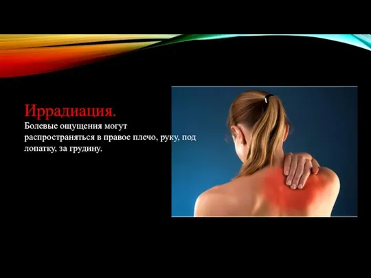 Иррадиация. Болевые ощущения могут распространяться в правое плечо, руку, под лопатку, за грудину.