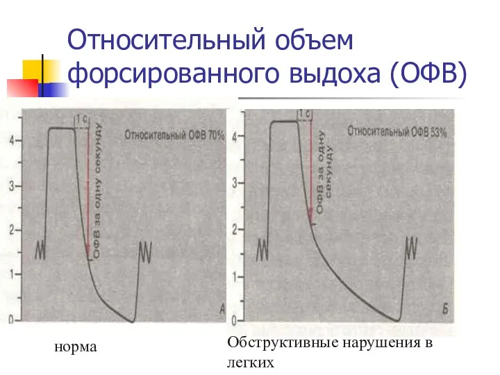 Относительный объем форсированного выдоха (ОФВ) норма Обструктивные нарушения в легких