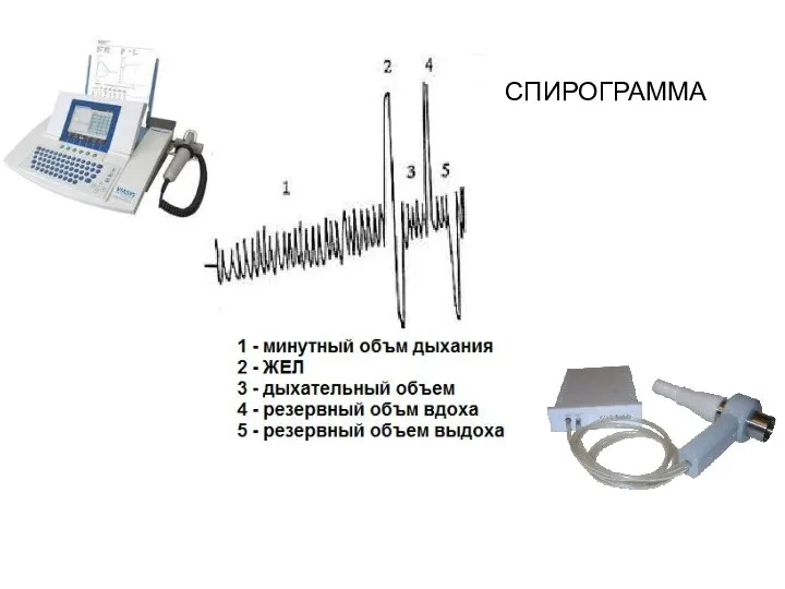 СПИРОГРАММА