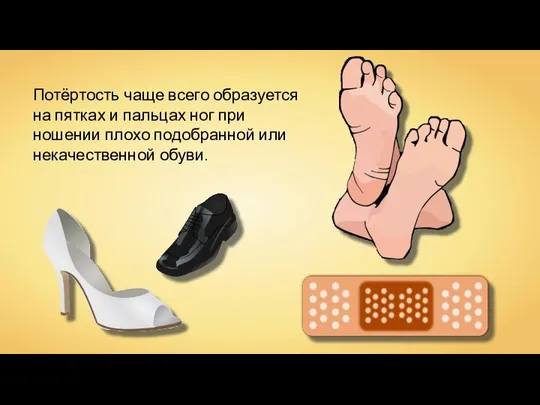 Потёртость чаще всего образуется на пятках и пальцах ног при ношении плохо подобранной или некачественной обуви.