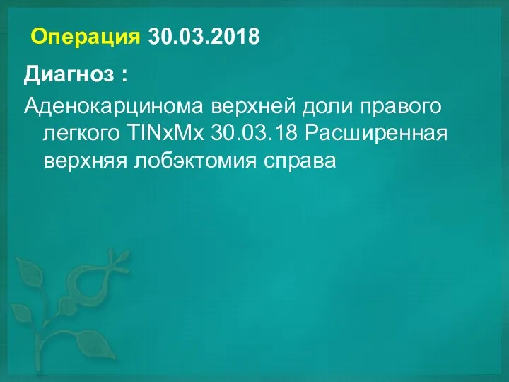 Операция 30.03.2018 Диагноз : Аденокарцинома верхней доли правого легкого TINxMx 30.03.18 Расширенная верхняя лобэктомия справа