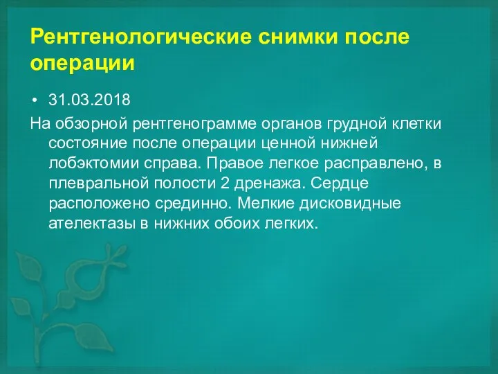 Рентгенологические снимки после операции 31.03.2018 На обзорной рентгенограмме органов грудной клетки