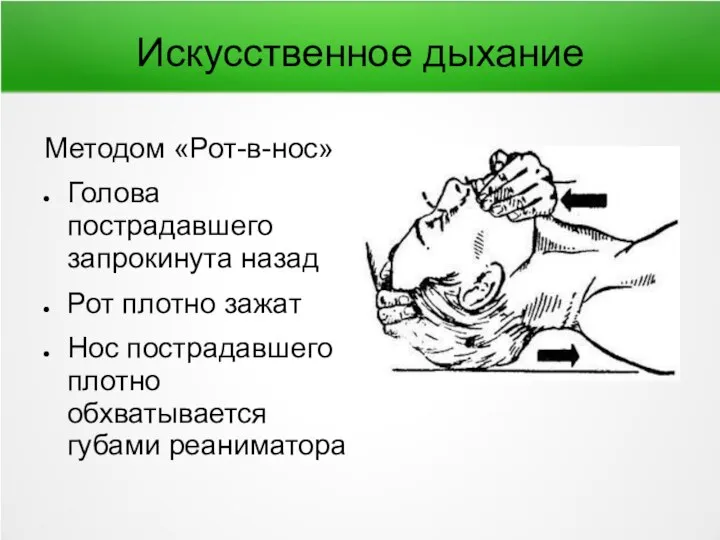 Искусственное дыхание Методом «Рот-в-нос» Голова пострадавшего запрокинута назад Рот плотно зажат