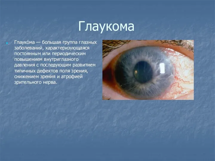Глаукома Глауко́ма — большая группа глазных заболеваний, характеризующаяся постоянным или периодическим