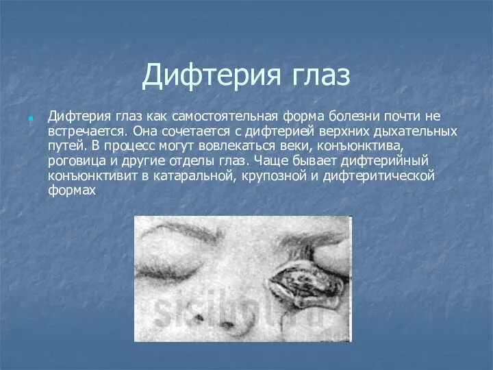 Дифтерия глаз Дифтерия глаз как самостоятельная форма болезни почти не встречается.