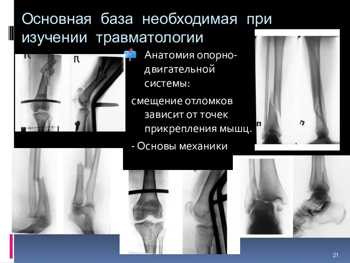 Основная база необходимая при изучении травматологии Анатомия опорно-двигательной системы: смещение отломков