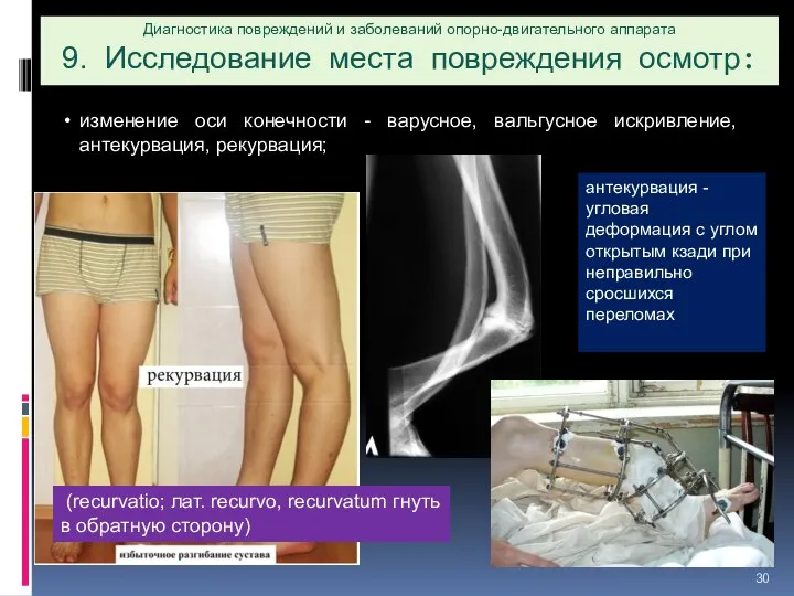 Диагностика повреждений и заболеваний опорно-двигательного аппарата 9. Исследование места повреждения осмотр: