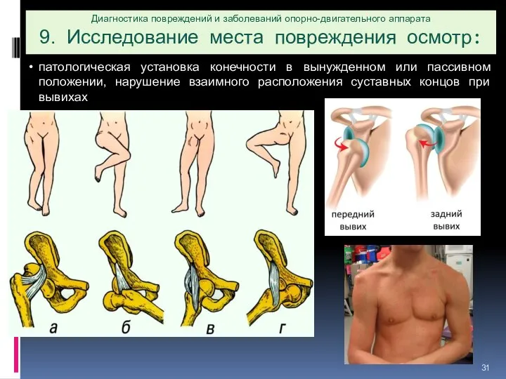 Диагностика повреждений и заболеваний опорно-двигательного аппарата 9. Исследование места повреждения осмотр: