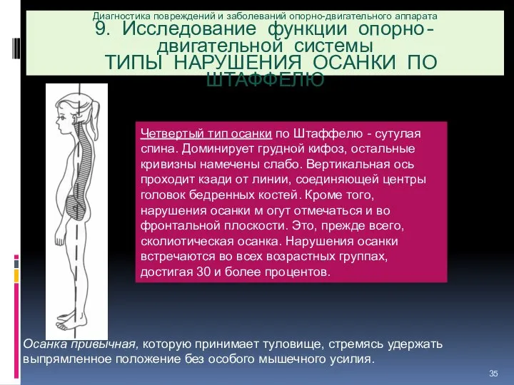 Диагностика повреждений и заболеваний опорно-двигательного аппарата 9. Исследование функции опорно-двигательной системы