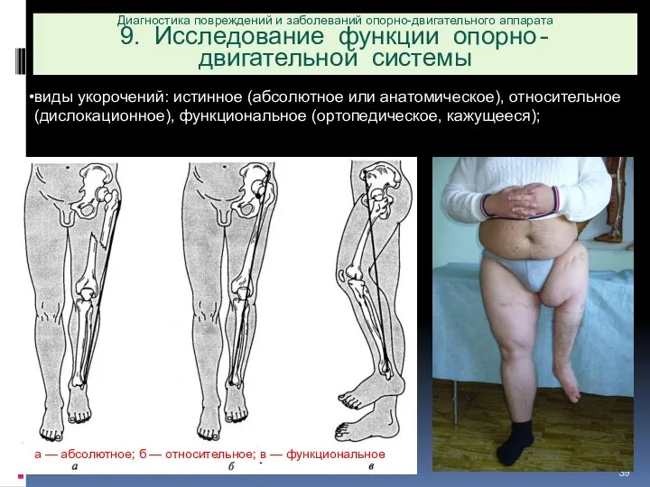 Диагностика повреждений и заболеваний опорно-двигательного аппарата 9. Исследование функции опорно-двигательной системы