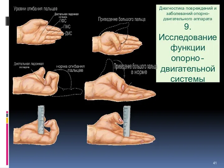 Диагностика повреждений и заболеваний опорно-двигательного аппарата 9. Исследование функции опорно-двигательной системы