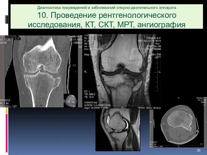 Диагностика повреждений и заболеваний опорно-двигательного аппарата 10. Проведение рентгенологического исследования, КТ, СКТ, МРТ, ангиография