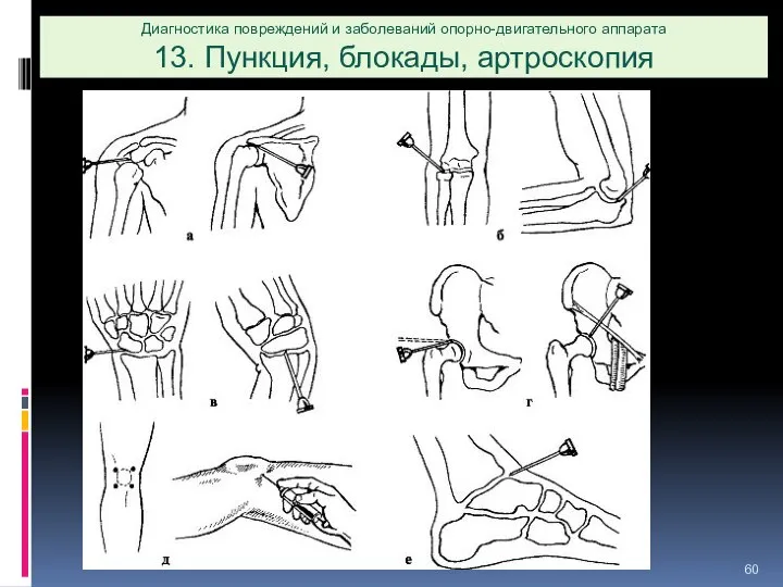 Диагностика повреждений и заболеваний опорно-двигательного аппарата 13. Пункция, блокады, артроскопия