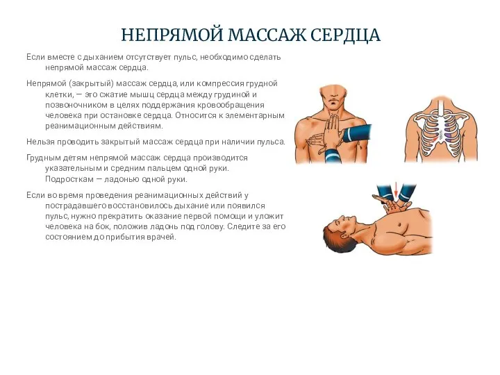 НЕПРЯМОЙ МАССАЖ СЕРДЦА Если вместе с дыханием отсутствует пульс, необходимо сделать